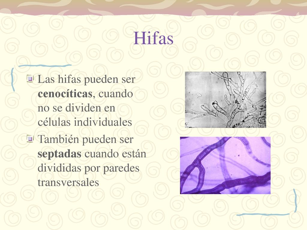 Hifas Las hifas pueden ser cenocíticas, cuando no se dividen en células individuales.