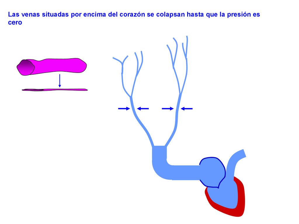 Las venas situadas por encima del corazón se colapsan hasta que la presión es cero