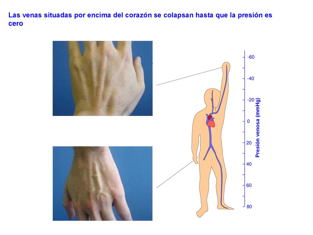 Las venas situadas por encima del corazón se colapsan hasta que la presión es cero