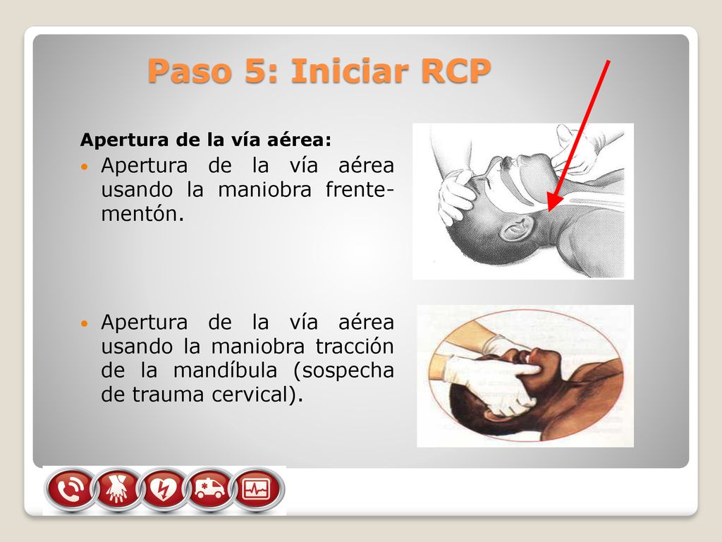 Paso 5: Iniciar RCP Apertura de la vía aérea: Apertura de la vía aérea usando la maniobra frente- mentón.