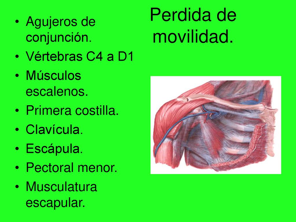 Perdida de movilidad. Agujeros de conjunción. Vértebras C4 a D1