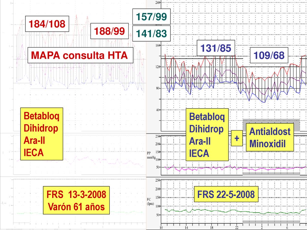 157/99 184/ / / /85. MAPA consulta HTA. 109/68. Betabloq. Dihidrop. Ara-II.