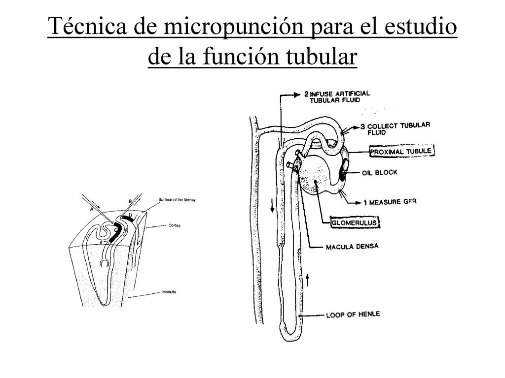 Técnica de micropunción para el estudio de la función tubular