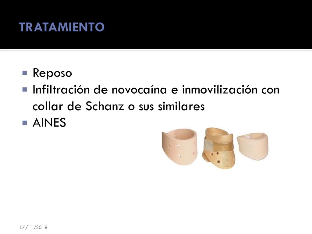 TRATAMIENTO Reposo. Infiltración de novocaína e inmovilización con collar de Schanz o sus similares.