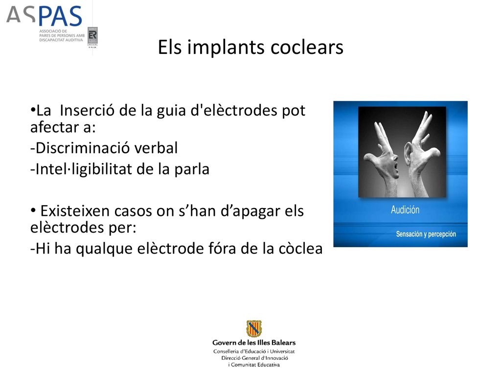 Els implants coclears La Inserció de la guia d elèctrodes pot afectar a: Discriminació verbal. Intel·ligibilitat de la parla.