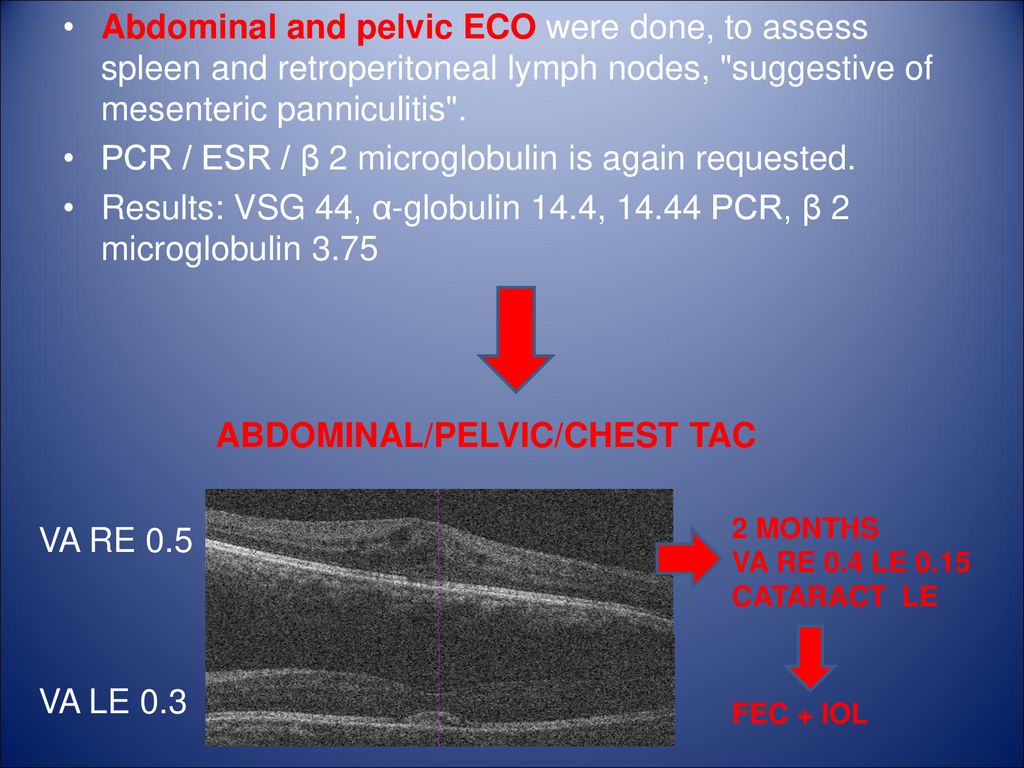 PCR / ESR / β 2 microglobulin is again requested.