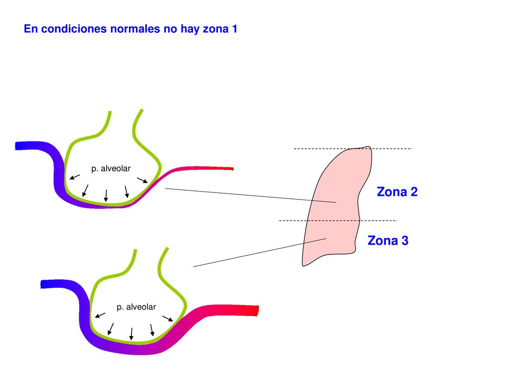 Zona 2 Zona 3 En condiciones normales no hay zona 1 p. alveolar