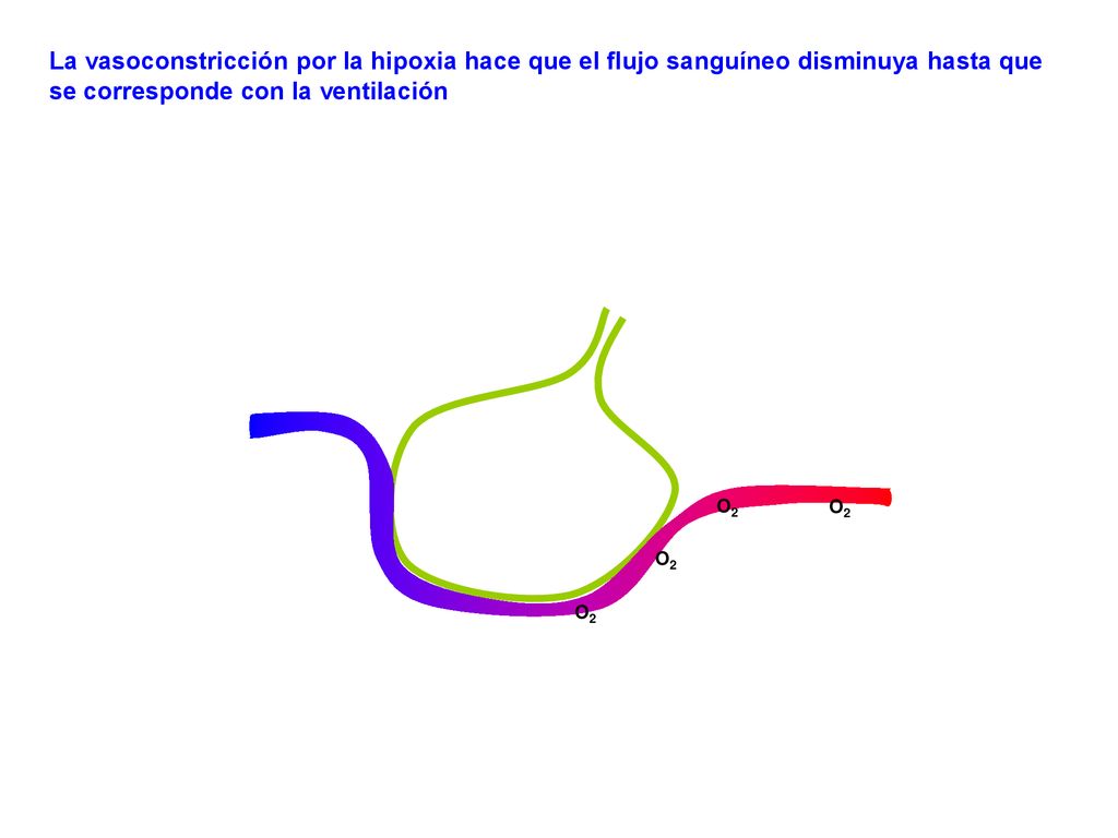 La vasoconstricción por la hipoxia hace que el flujo sanguíneo disminuya hasta que se corresponde con la ventilación