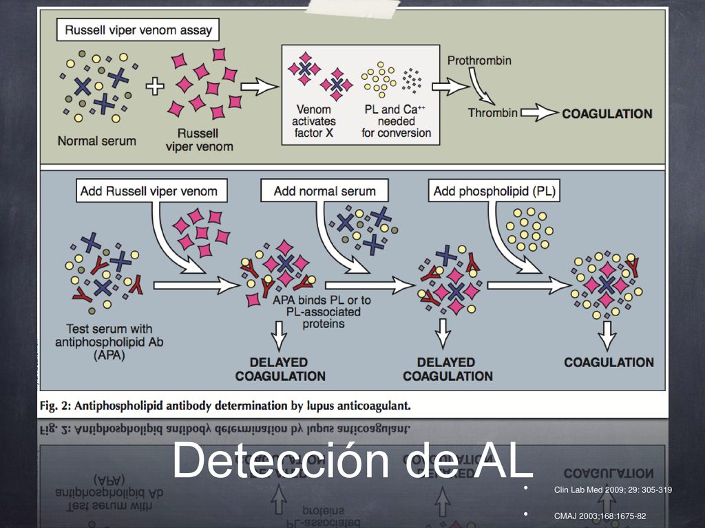 Detección de AL Clin Lab Med 2009; 29: CMAJ 2003;168: