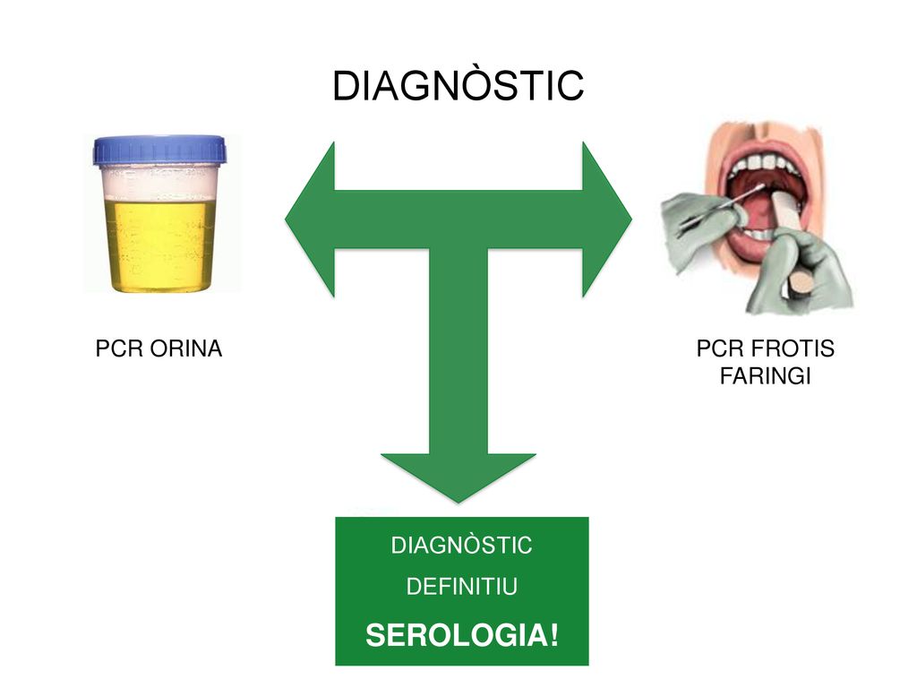 A URGÈNCIES FEM: SEROLOGIA PCR ORINA PCR FROTIS FARINGI DIAGNÒSTIC