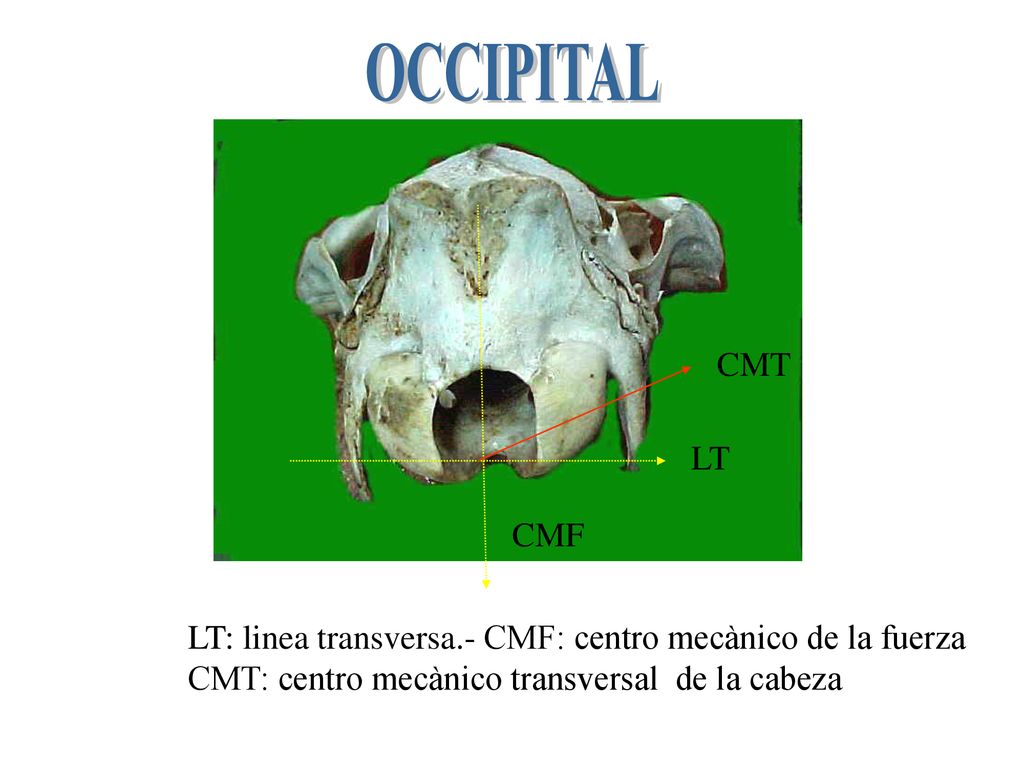 OCCIPITAL CMT. LT. CMF. LT: linea transversa.- CMF: centro mecànico de la fuerza.