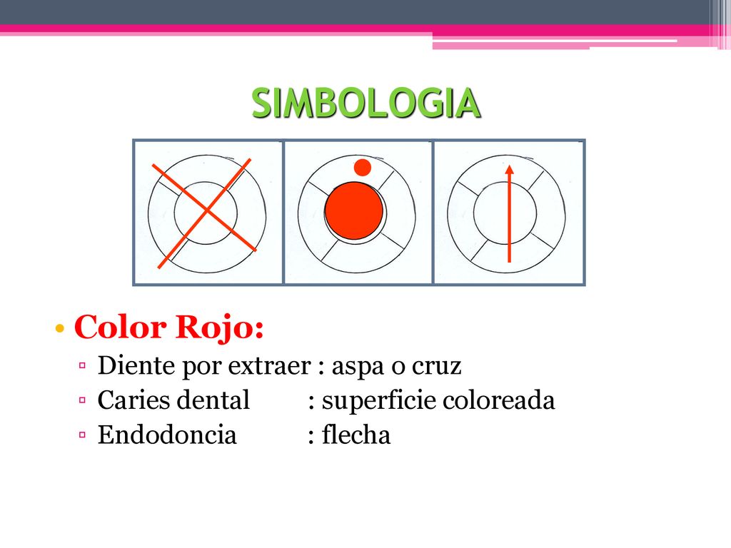 SIMBOLOGIA Color Rojo: Diente por extraer : aspa o cruz