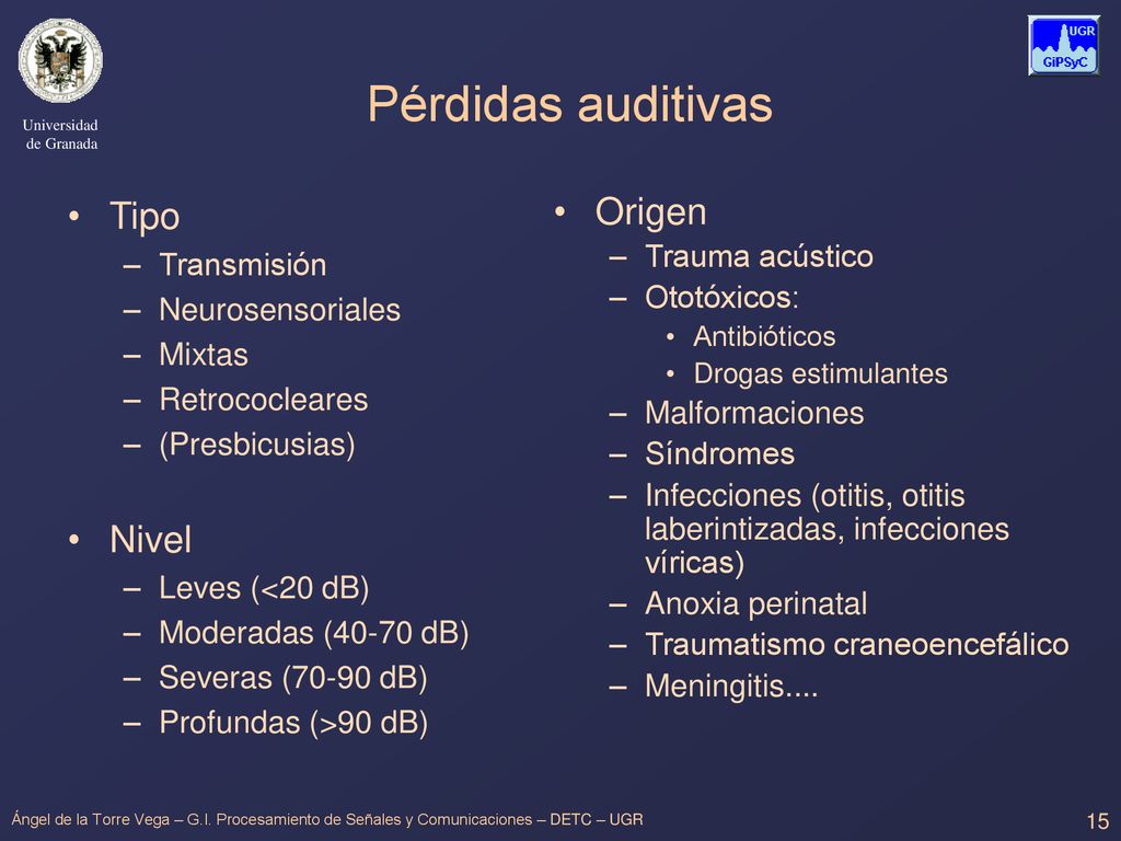 Pérdidas auditivas Tipo Nivel Origen Transmisión Trauma acústico