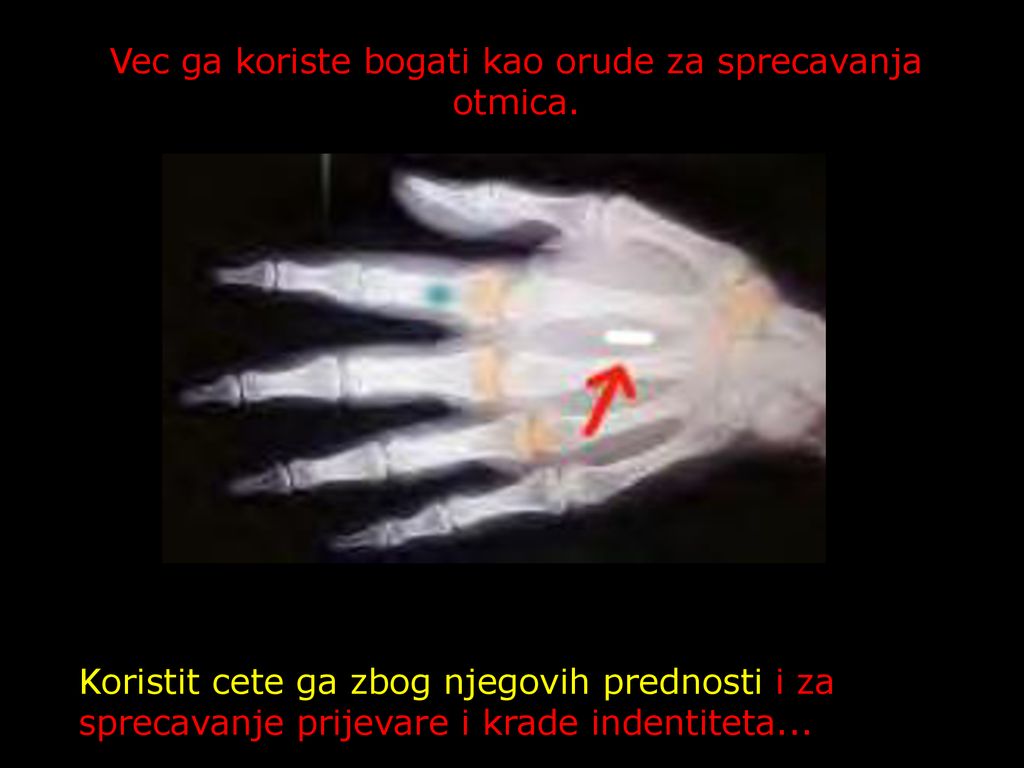 Vec ga koriste bogati kao orude za sprecavanja otmica.