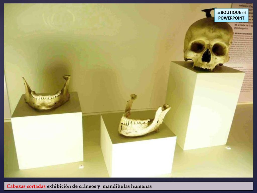 Cabezas cortadas exhibición de cráneos y mandíbulas humanas