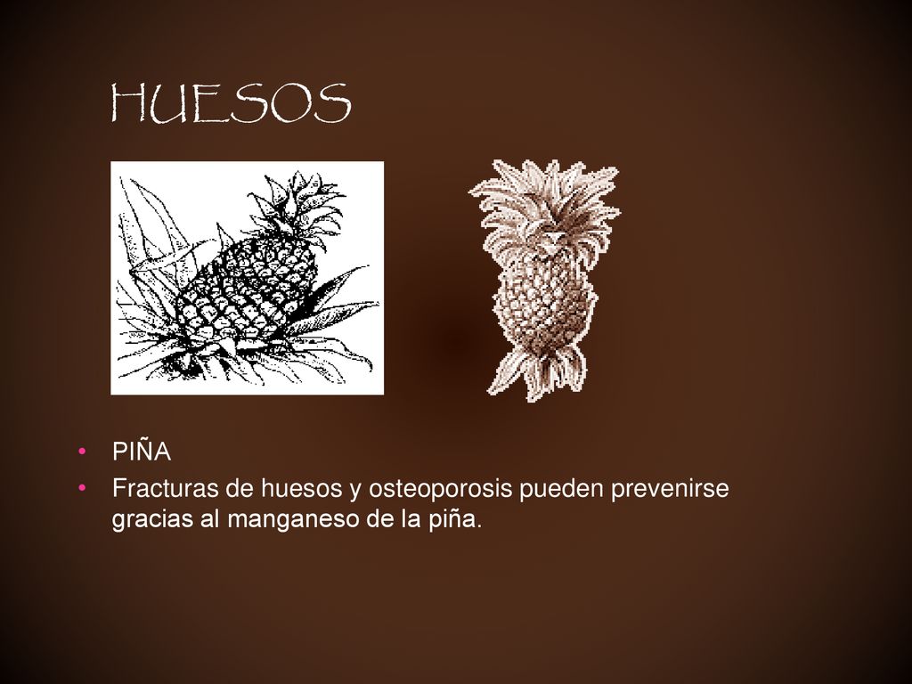 HUESOS PIÑA Fracturas de huesos y osteoporosis pueden prevenirse gracias al manganeso de la piña.