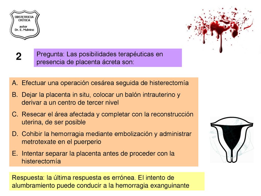 2 Pregunta: Las posibilidades terapéuticas en presencia de placenta ácreta son: Efectuar una operación cesárea seguida de histerectomía.