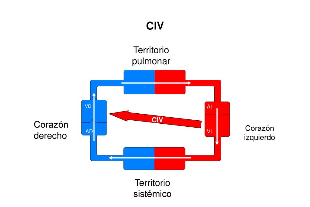 CIV Territorio pulmonar Corazón derecho Territorio sistémico