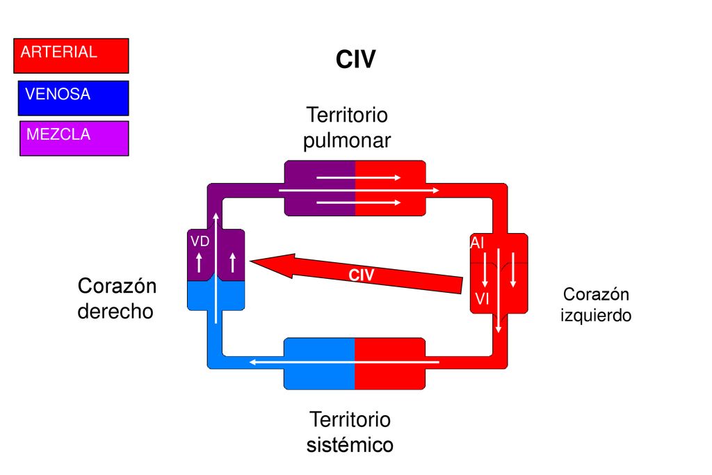 CIV Territorio pulmonar Corazón derecho Territorio sistémico