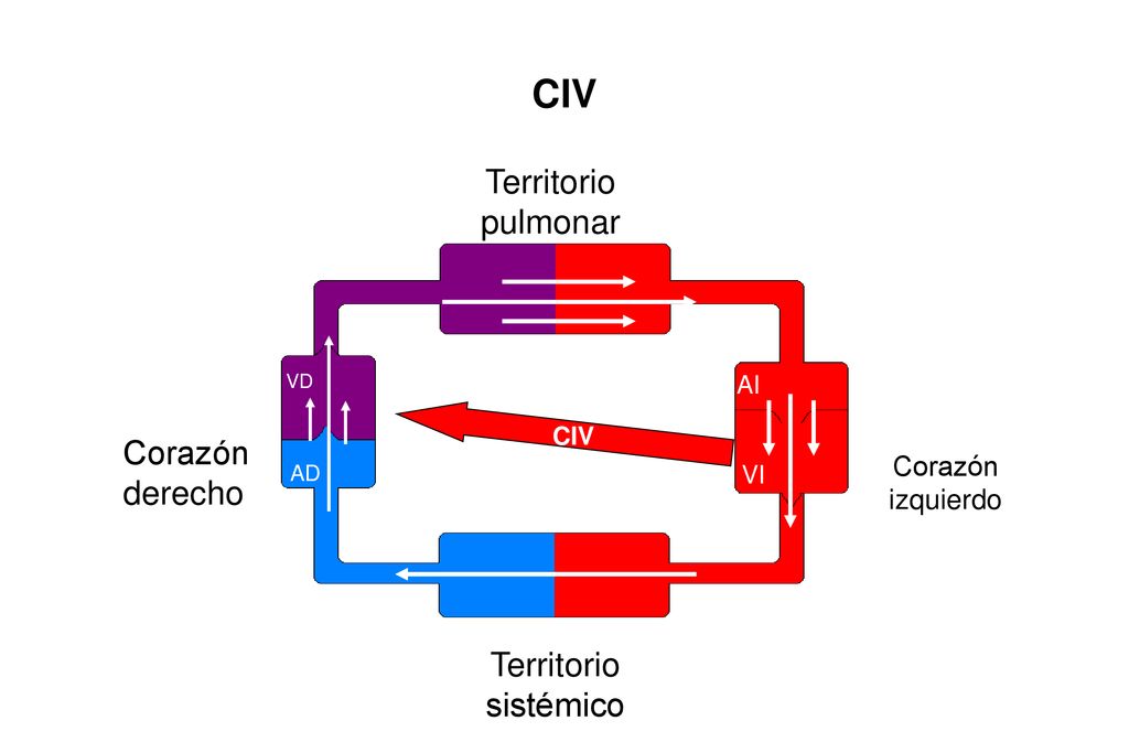 CIV Territorio pulmonar Corazón derecho Territorio sistémico