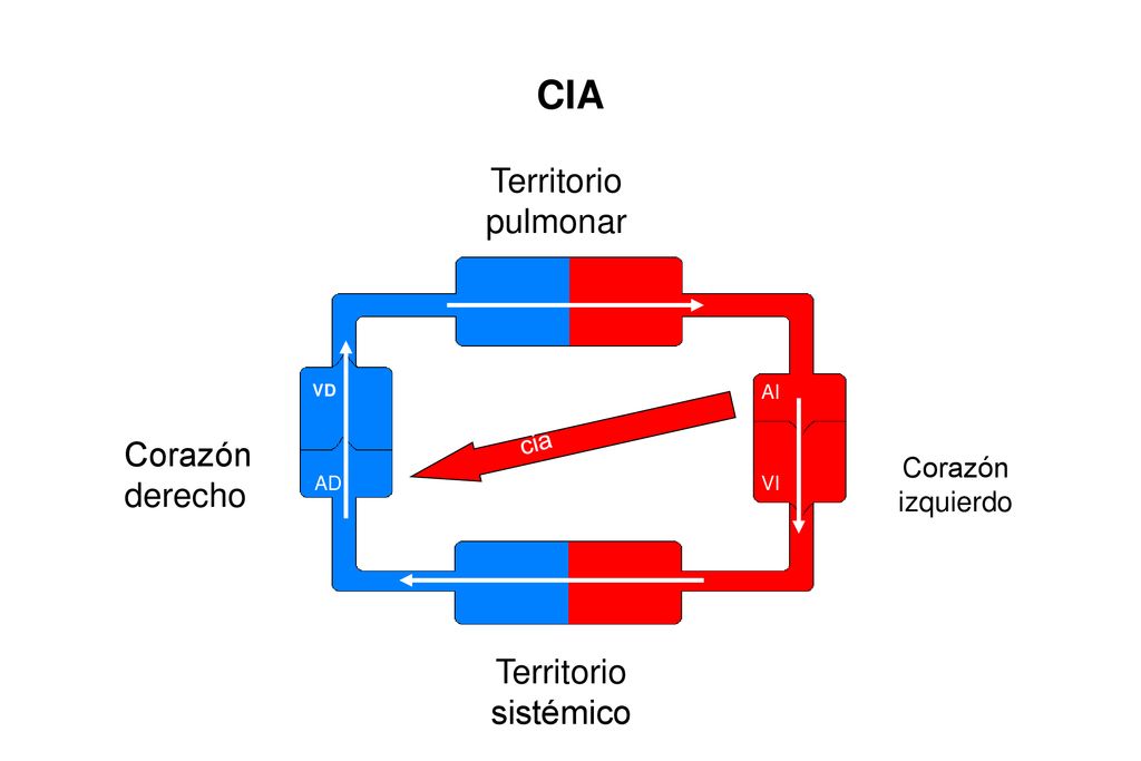CIA Territorio pulmonar Corazón derecho Territorio sistémico