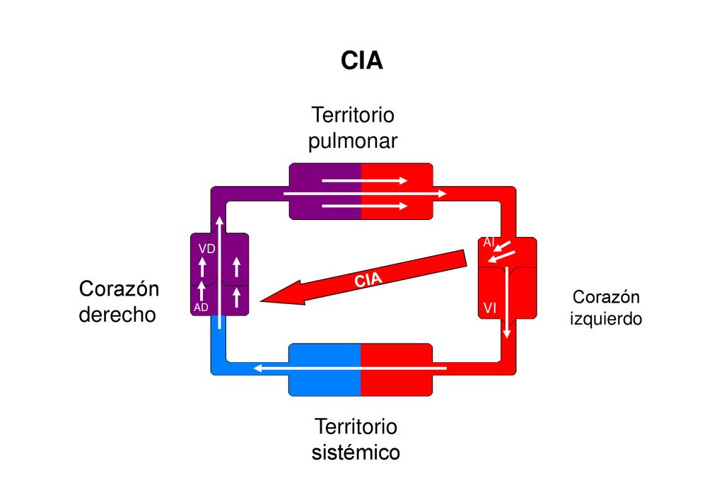 CIA Territorio pulmonar Corazón derecho Territorio sistémico