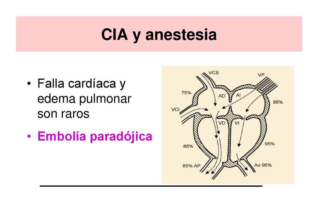 CIA y anestesia Falla cardíaca y edema pulmonar son raros