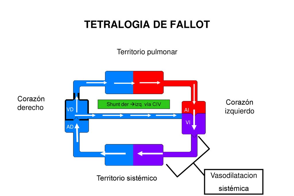 TETRALOGIA DE FALLOT Territorio pulmonar Corazón derecho