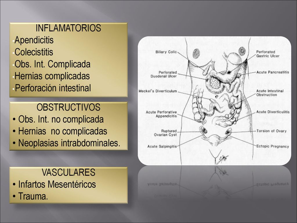 INFLAMATORIOS Apendicitis. Colecistitis. Obs. Int. Complicada. Hernias complicadas. Perforación intestinal.