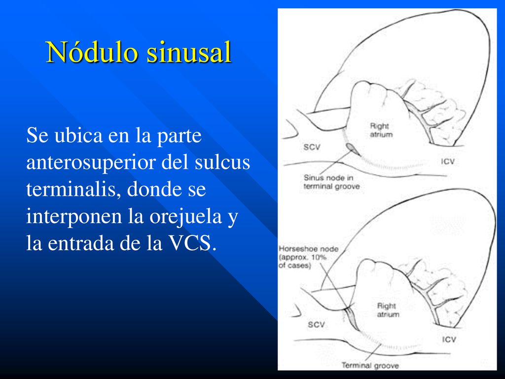 Nódulo sinusal Se ubica en la parte anterosuperior del sulcus terminalis, donde se interponen la orejuela y la entrada de la VCS.