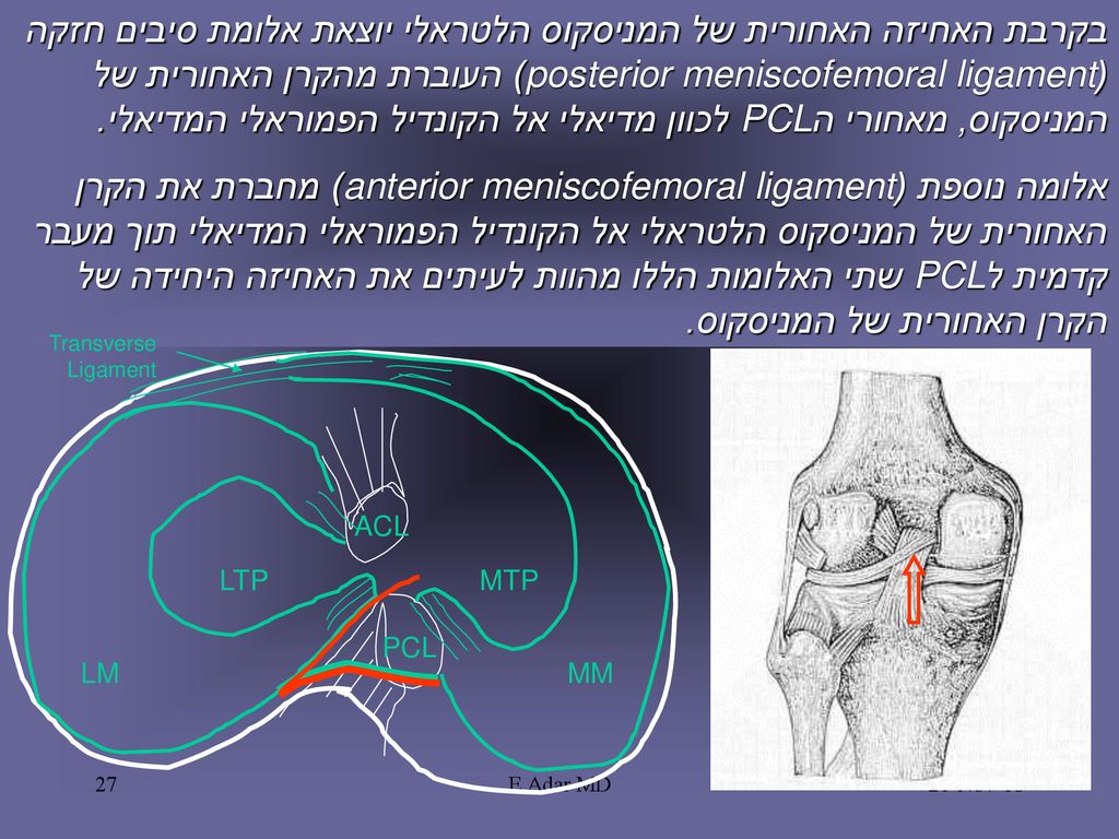 בקרבת האחיזה האחורית של המניסקוס הלטראלי יוצאת אלומת סיבים חזקה (posterior meniscofemoral ligament) העוברת מהקרן האחורית של המניסקוס, מאחורי הPCL לכוון מדיאלי אל הקונדיל הפמוראלי המדיאלי.