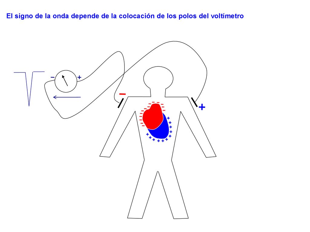 El signo de la onda depende de la colocación de los polos del voltímetro