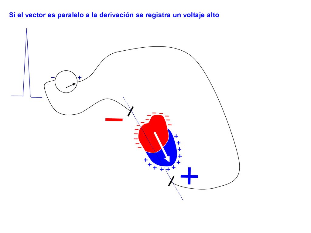 Si el vector es paralelo a la derivación se registra un voltaje alto