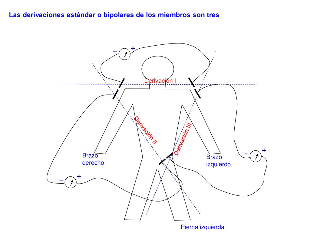 Las derivaciones estándar o bipolares de los miembros son tres