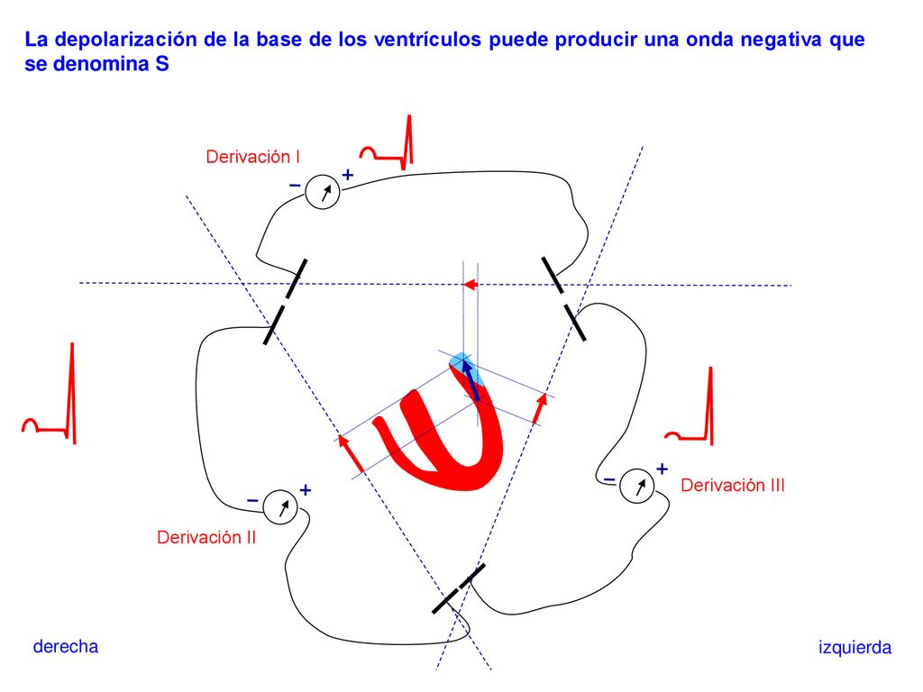 La depolarización de la base de los ventrículos puede producir una onda negativa que se denomina S