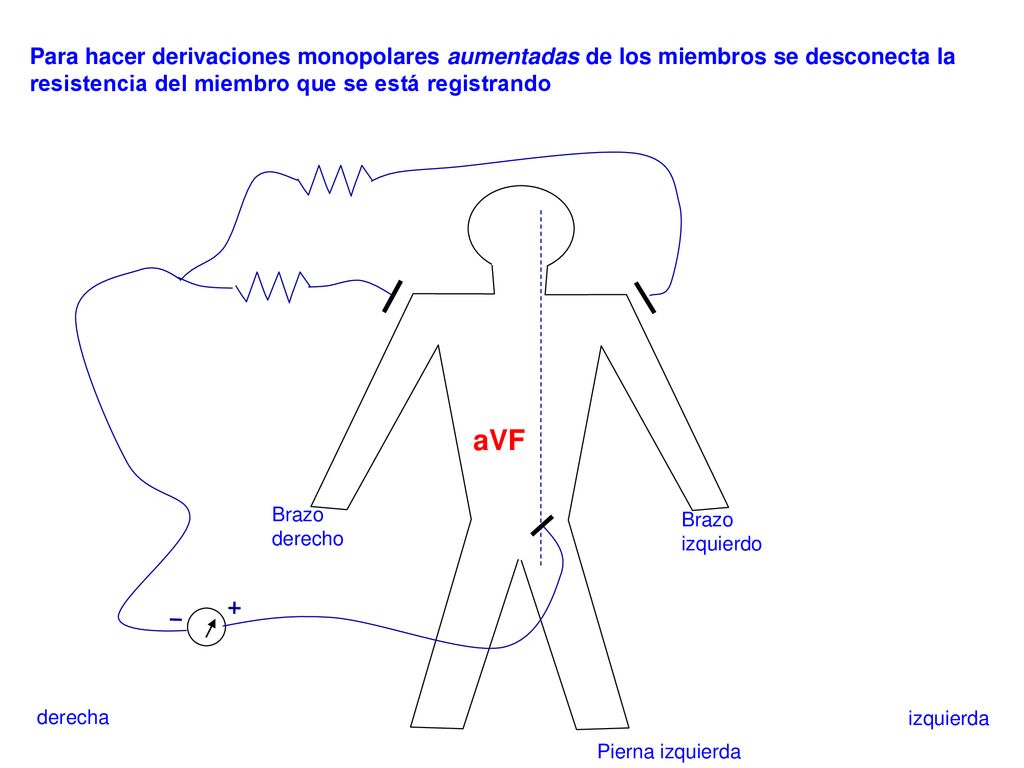 Para hacer derivaciones monopolares aumentadas de los miembros se desconecta la resistencia del miembro que se está registrando