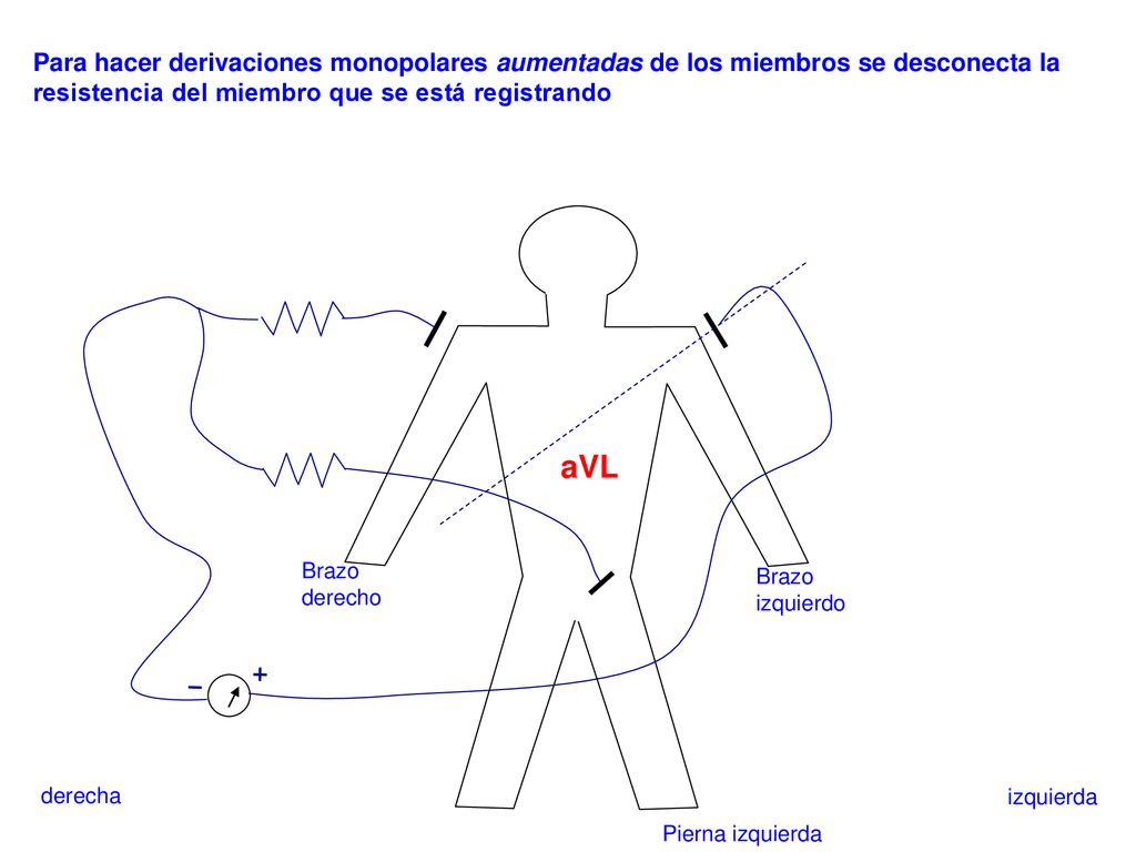 Para hacer derivaciones monopolares aumentadas de los miembros se desconecta la resistencia del miembro que se está registrando