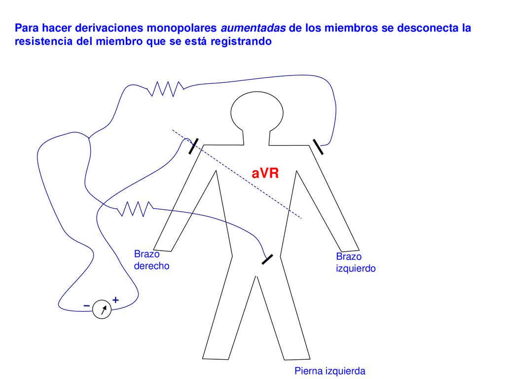 Para hacer derivaciones monopolares aumentadas de los miembros se desconecta la resistencia del miembro que se está registrando