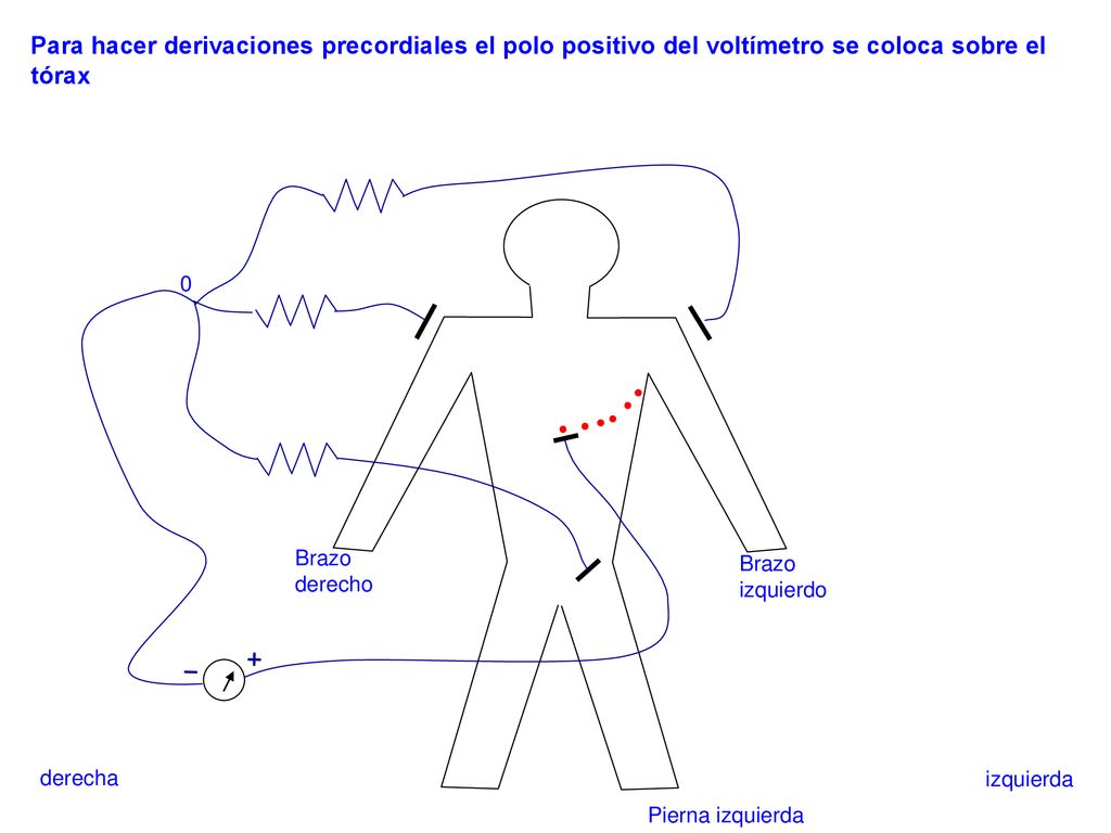 Para hacer derivaciones precordiales el polo positivo del voltímetro se coloca sobre el tórax