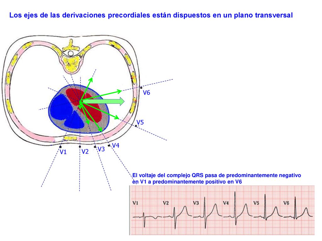 Los ejes de las derivaciones precordiales están dispuestos en un plano transversal