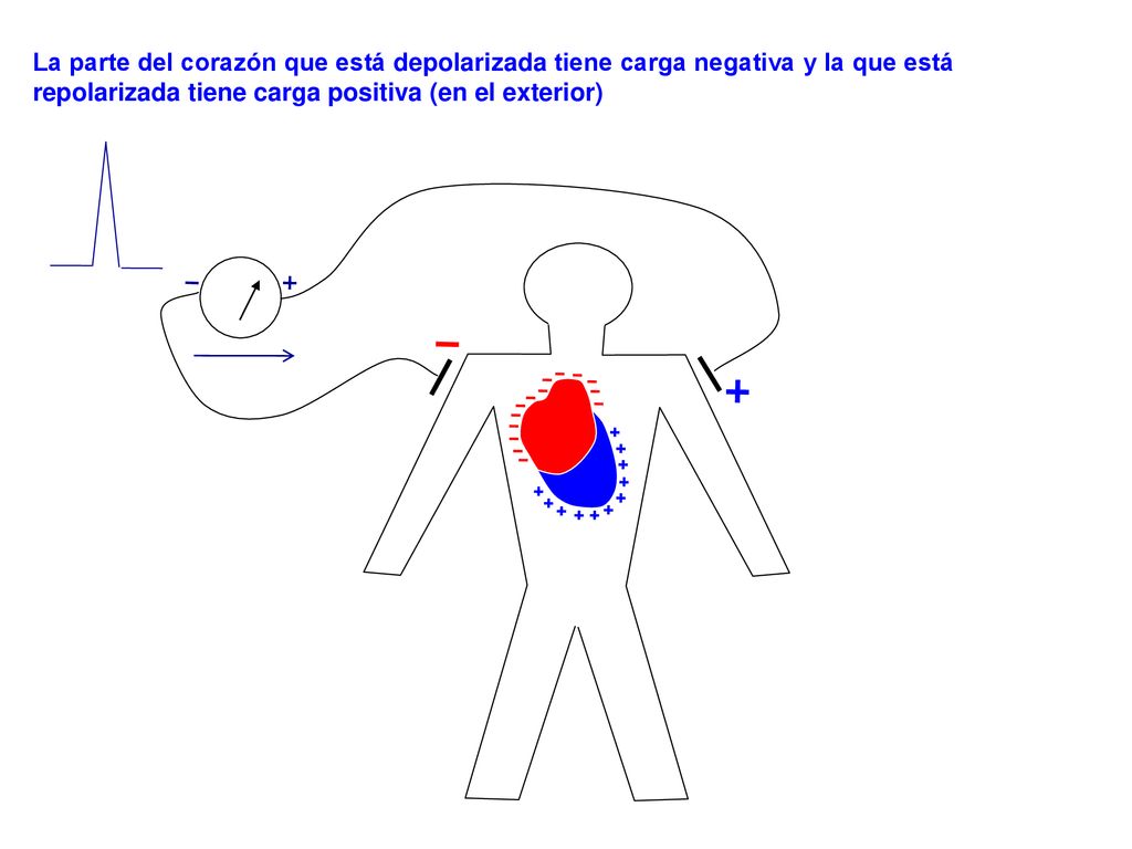 La parte del corazón que está depolarizada tiene carga negativa y la que está repolarizada tiene carga positiva (en el exterior)