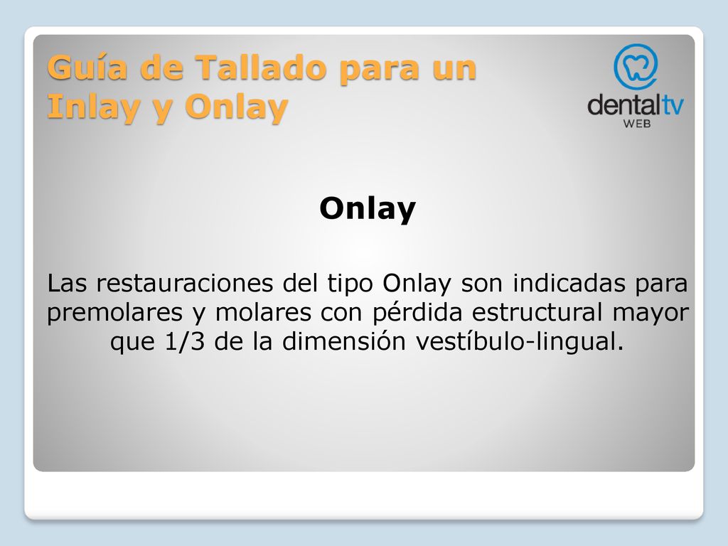 Guía de Tallado para un Inlay y Onlay