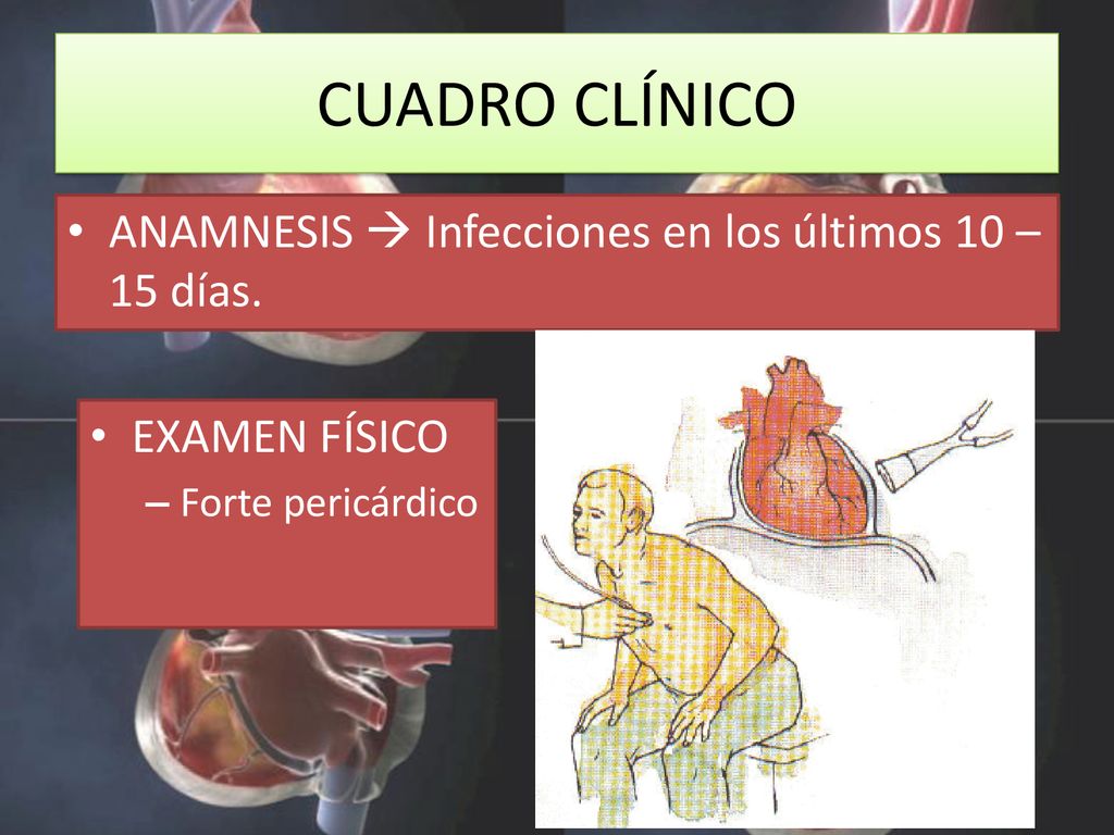 CUADRO CLÍNICO ANAMNESIS  Infecciones en los últimos 10 – 15 días.