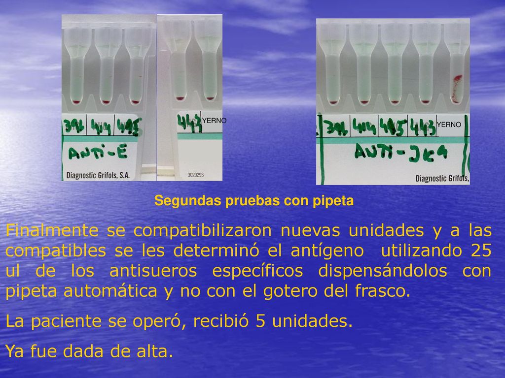 La paciente se operó, recibió 5 unidades. Ya fue dada de alta.