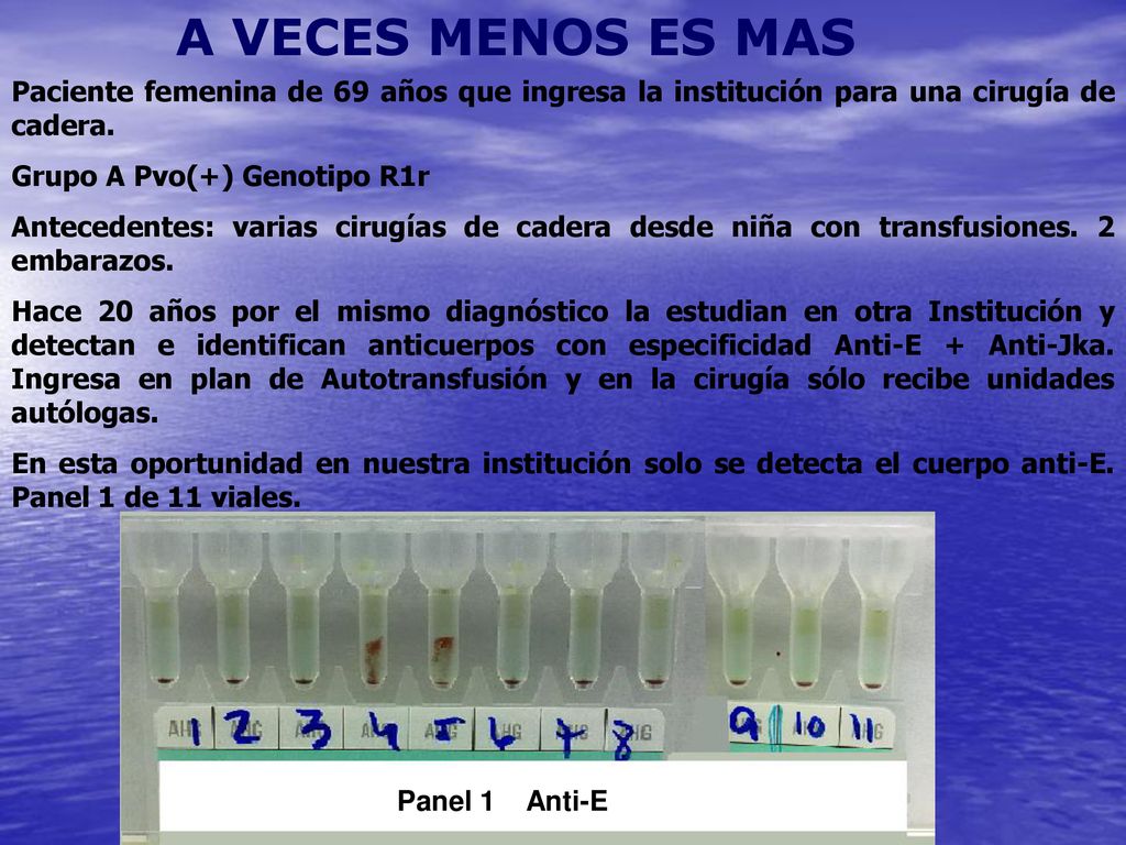 A VECES MENOS ES MAS Paciente femenina de 69 años que ingresa la institución para una cirugía de cadera.