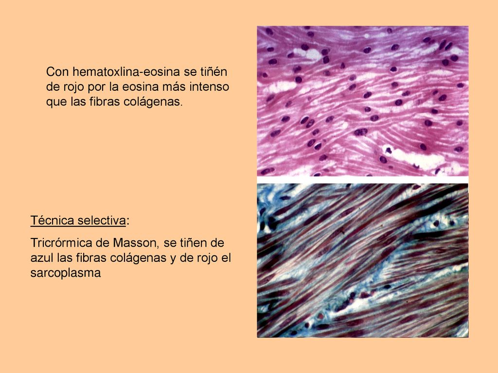 Con hematoxlina-eosina se tiñén de rojo por la eosina más intenso que las fibras colágenas.