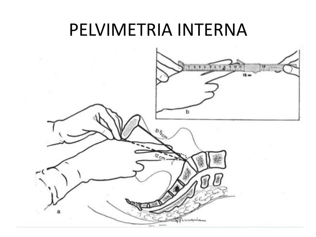 PELVIMETRIA DRA. DEBORAH GAIBOR. - ppt descargar