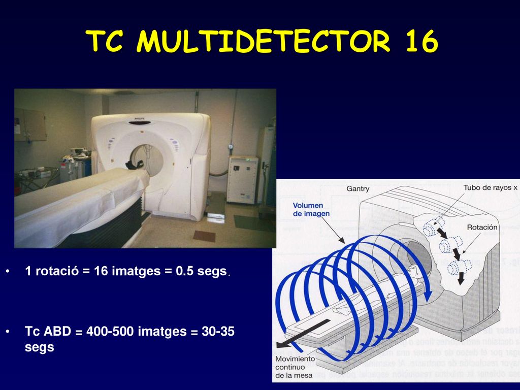 TC MULTIDETECTOR 16 1 rotació = 16 imatges = 0.5 segs.