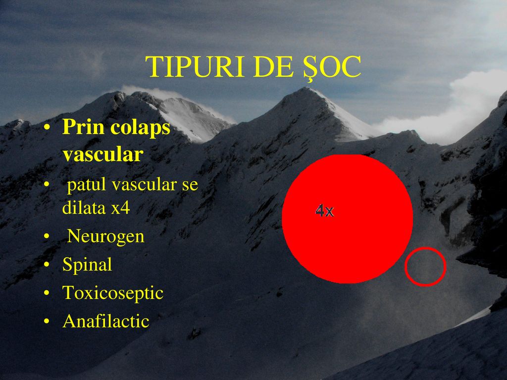 TIPURI DE ŞOC Prin colaps vascular patul vascular se dilata x4
