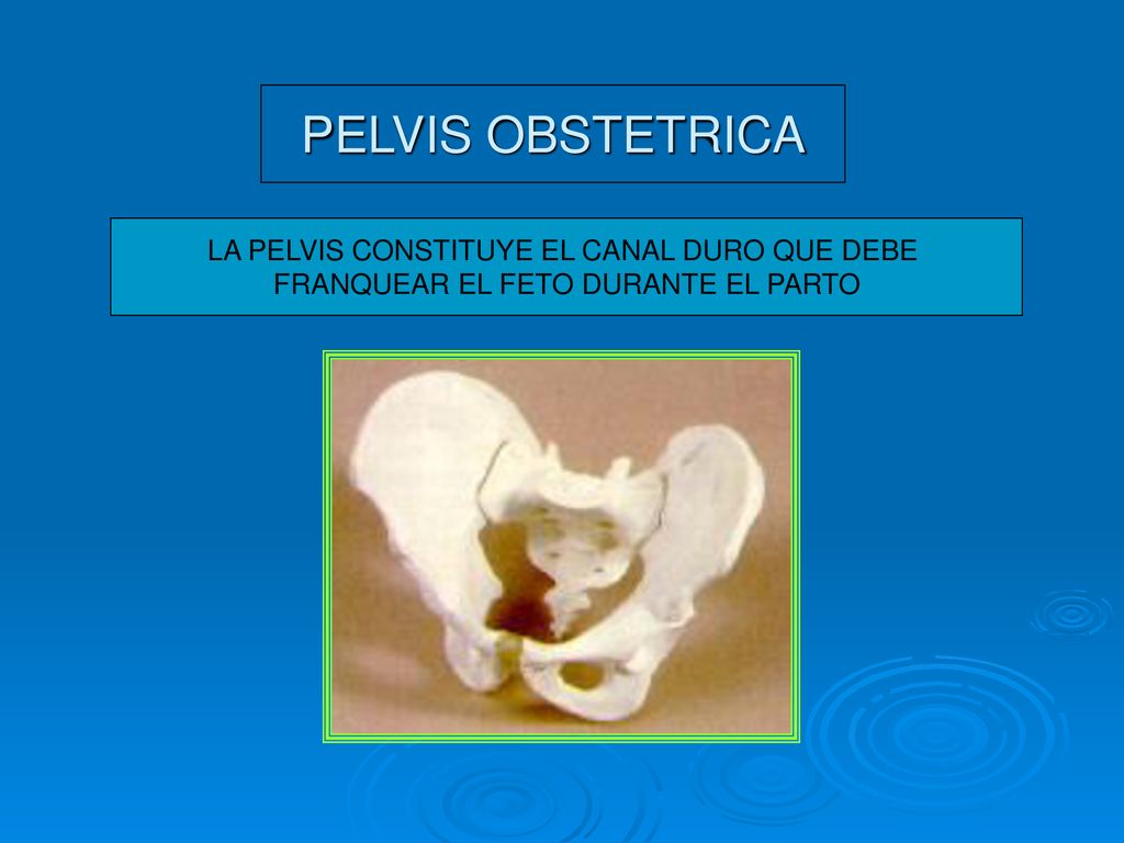 PELVIS OBSTETRICA LA PELVIS CONSTITUYE EL CANAL DURO QUE DEBE